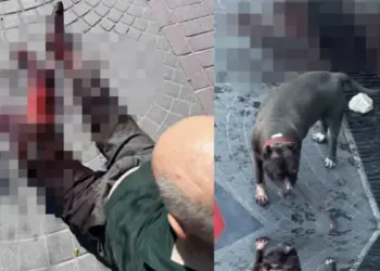 İstanbul’da pitbull Köpeği Vakası ! 1 kişi yaralandı