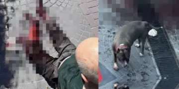 İstanbul’da pitbull Köpeği Vakası ! 1 kişi yaralandı